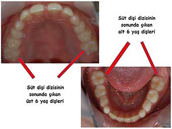 Cenap Adaş Çocuk Diş Sağlığı (Pedodonti)