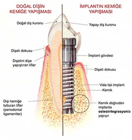 Cenap Adaş İmplantlar